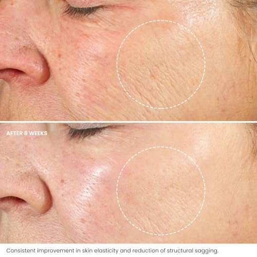 Retinol Face Cream with Hyaluronic Acid & Vitamin E – Anti-Wrinkle Firming Night Cream - Hydrating Night Moisturiser to Reduce Lines and Wrinkles. For Sensitive Skin, 50ml