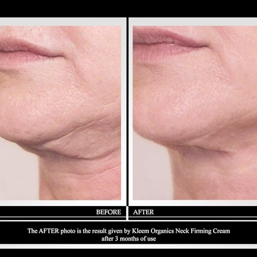 Neck Firming Cream with Peptides & Retinol – Anti-Aging Moisturiser for Sagging Skin, Wrinkles & Fine Lines – Hydrating Neck & Décolleté Cream – EWG Certified, Vegan & Cruelty-Free – 50ml