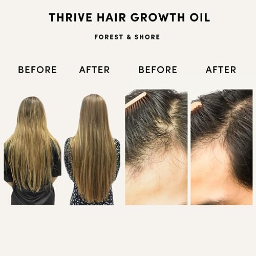 Hair Growth Oil 100% Natural Hair Oil with Caffeine, Biotin, Castor Oil, Argan Oil, Coconut Oil, and Rosemary Oil Effective Thickening Mask & Hair Loss Treatment