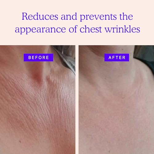 Chest Wrinkle Pads - Silicone Anti Wrinkle Patches for Wrinkles Smoothing - Reusable Overnight Silicone Wrinkle Patches - Anti Aging Silicone Chest Pad & Patch - Neck & Décolleté (1-mo Supply)