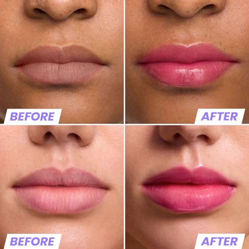 Wonderskin Lip Rehab Serum Oil - Color Changing Lip Oil from Clear to Pink - PH-activated, Non-sticky & Hydrating Tinted Lip Oil for Dry Lips (Kissed)