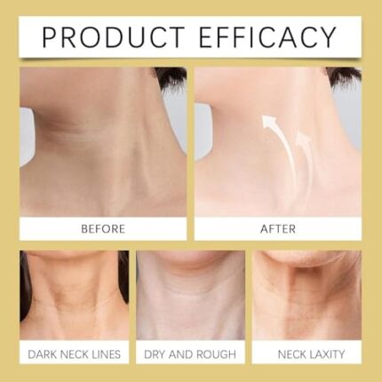AH-8 Firming Neck Cream, Tighten and Lift Neck Cream with Double Roller Massage, Reduce Wrinkles Fine Lines And Double Chin, Firm and Lift Sagging Skin(120g)